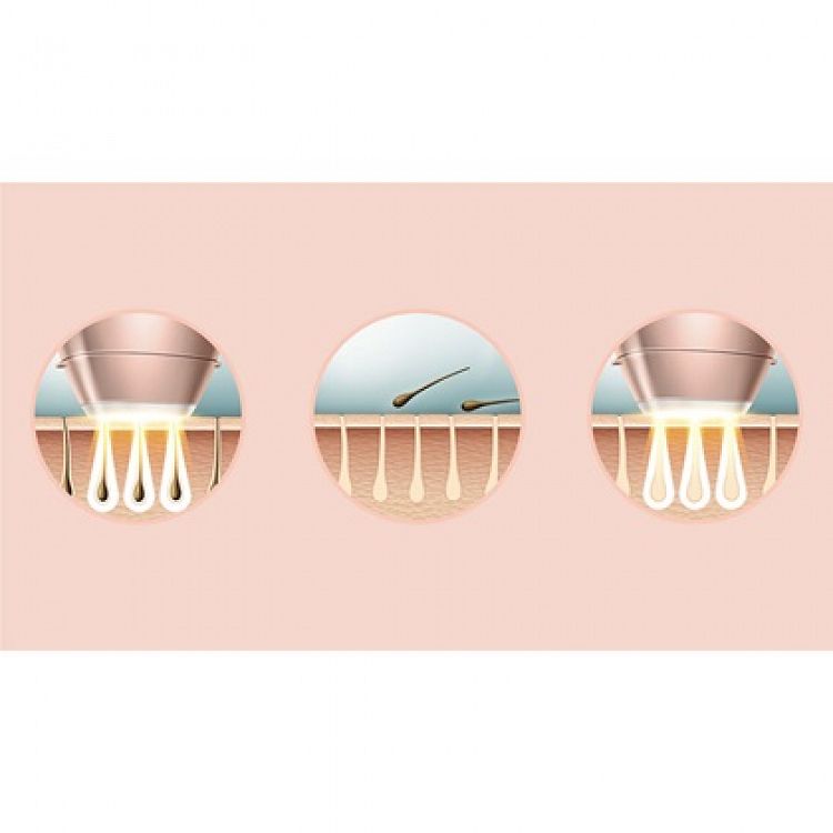 Αποτριχωτικό Σύστημα IPL Philips Lumea Prestige BRI955/00